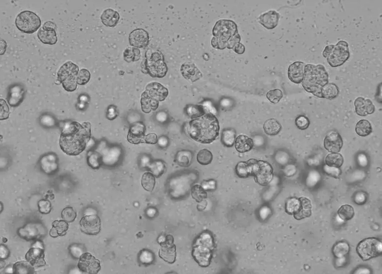 3D cell culture results