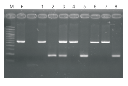 Figure 3. The results of direct amplification of animal tissue direct PCR kit for detection of gene knockout animals.