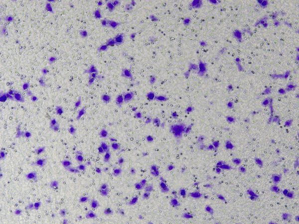 Results of crystal violet staining after cell invasion