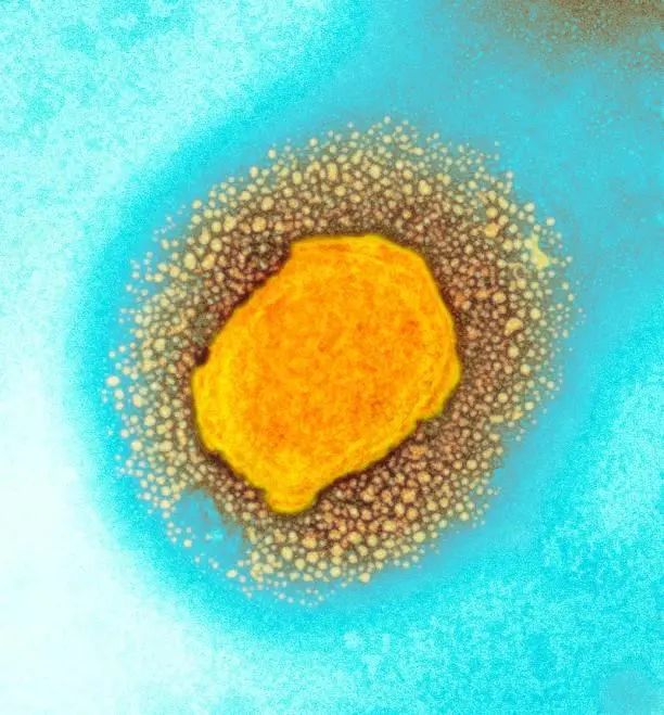 Figure 1. Monkeypox virus