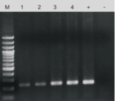 Figure 5. SOX21 gene amplification results of mouse tail treated with different lysis methods.