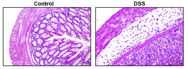 Figure 2. HE staining results of DSS acute colitis sections